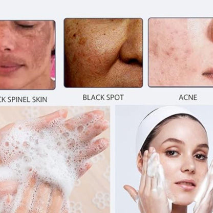 लुकाची फॉर एक्ने स्पॉट क्लींजिंग लोशन 50 एमएल (2 का पैक)